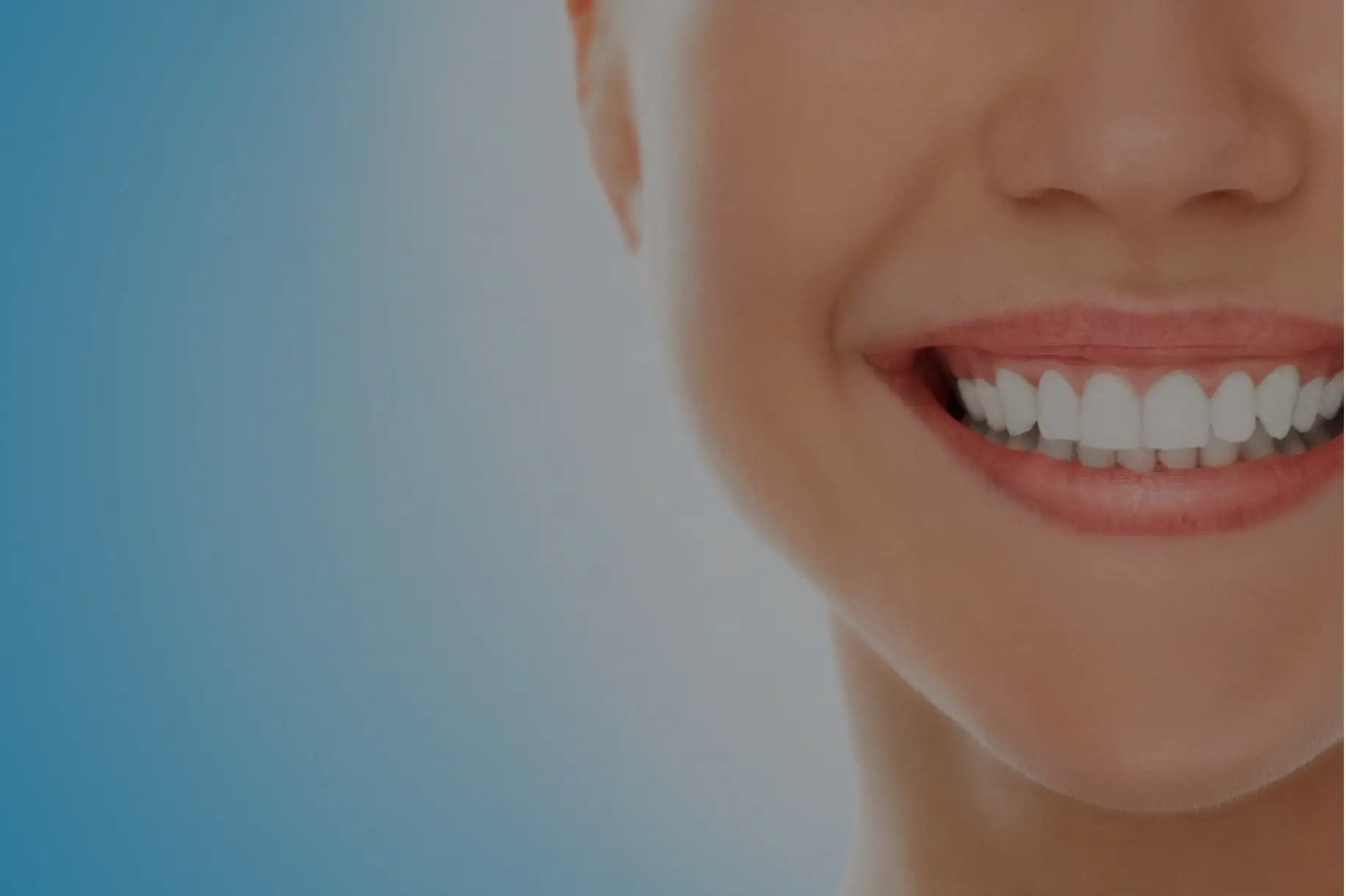 Healthy smile with white teeth and composite bonding at Cronin Dental Cork